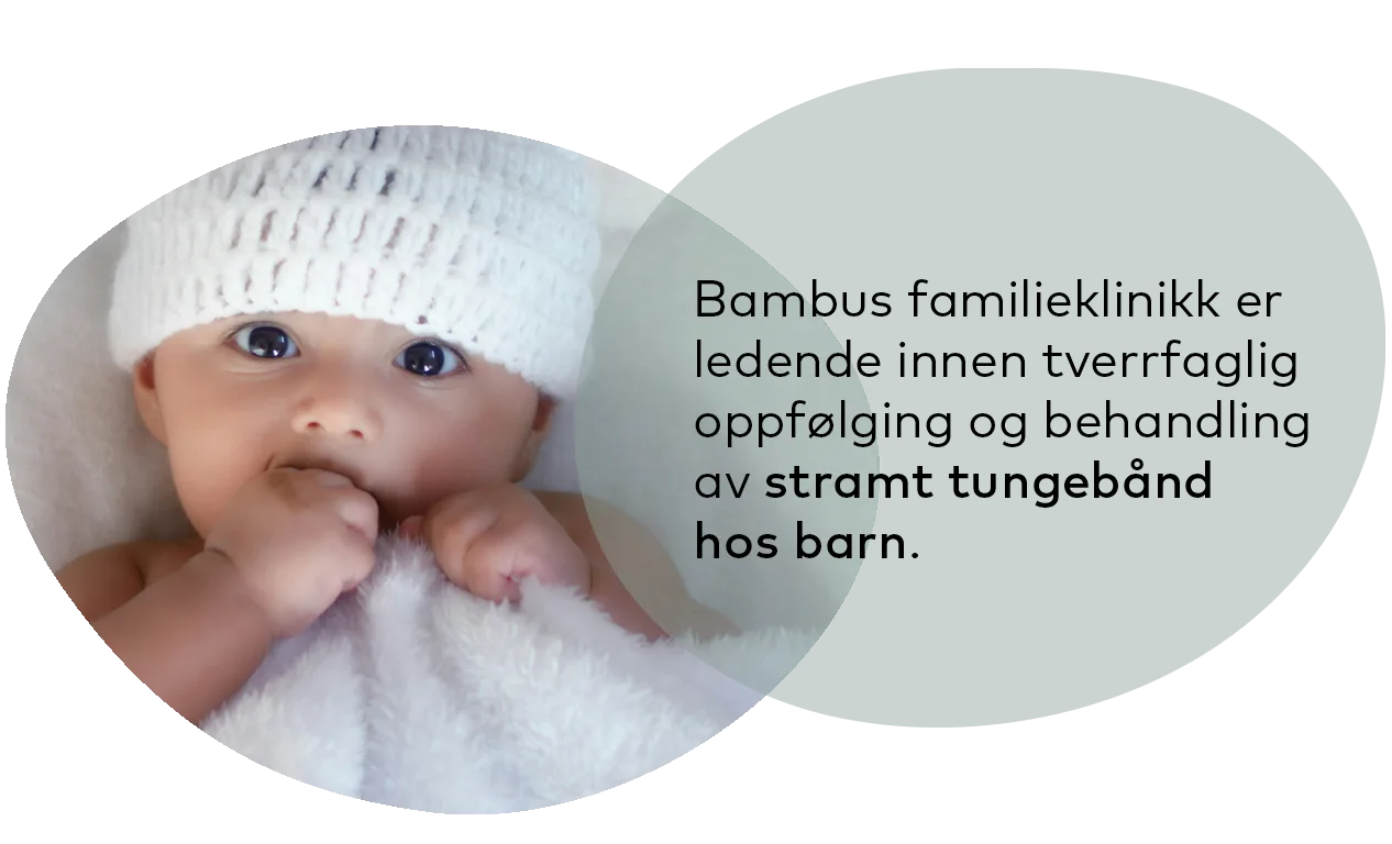 En baby med hvit lue, med tekst som sier at Bambus familieklinikk spesialiserer seg på behandling av bundet tunge hos barn.